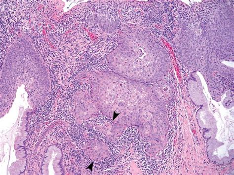 Pathology Oncohema Key