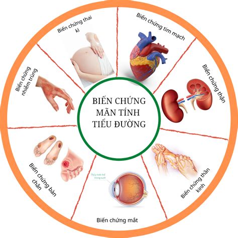 Chia sẻ với hơn 73 về mô hình chuột đái tháo đường tuýp 1 mới nhất