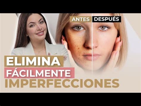 Recupera La Luminosidad De Tu Piel Conoce Los Beneficios Del