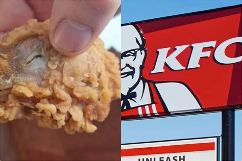 Yuck Woman Finds Chicken Head With Eyes And Beak In Kfc Meal Box