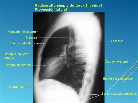 Torax normal en Imagenología PPT