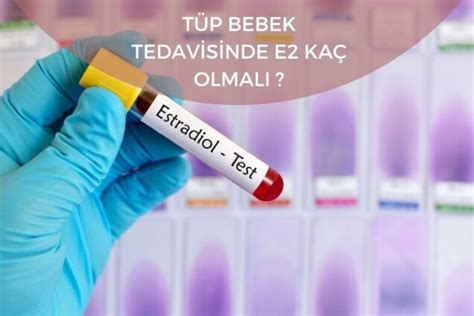 Tüp bebek tedavisinde E2 kaç olmalı Kısırlık TedavisiKısırlık Tedavisi