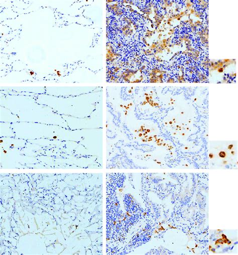 Representative Positive Ihc Staining For Tim 3 Cd68 And Cd163 In Download Scientific Diagram