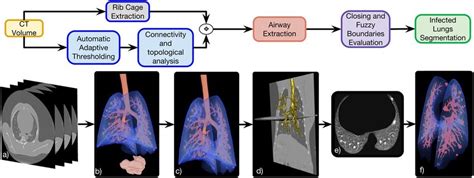 Automatic Lung Segmentation Pipeline A Source Chest Ct Volume B