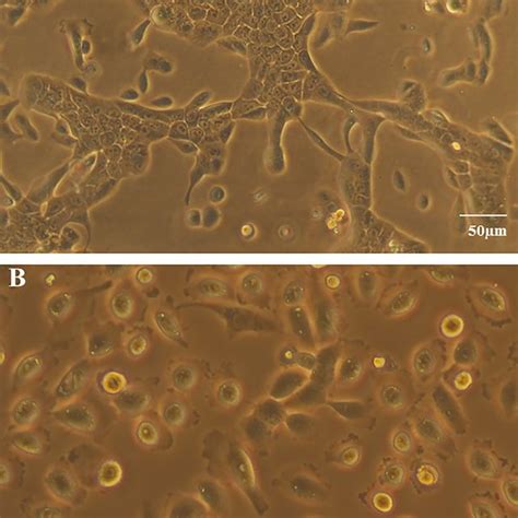 Human Mammary Epithelial MCF 12A Cells Cultured In The Media Without