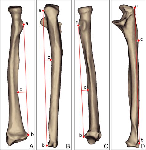 45 Radius And Ulna Diagram Elicaechetam