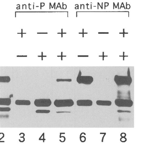 Detection Of Np P Complexes By Western Blot Hela Cells Infected With