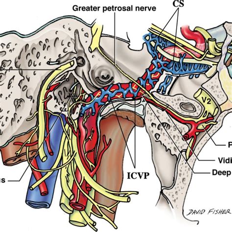 Lateral Cadaveric View Of The Right Petrous Part Of The Internal