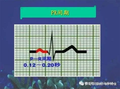 招飞体检常见心电图术语及鉴定：短pr间期 知乎