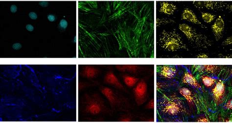 NIR Lasers Power Advanced Multiplexed Confocal Imaging | Olympus LS