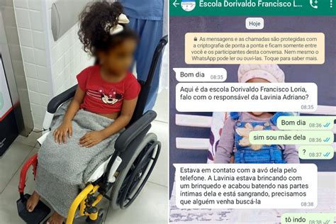 Polícia investiga caso de criança de 3 anos que teve sangramento em