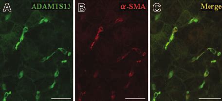 Confocal Laser Scanning Immunofluorescence Microscopy Using Frozen