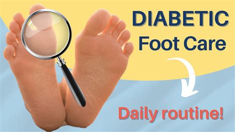 Diabetic Foot Care At Home Daily Routine YouTube