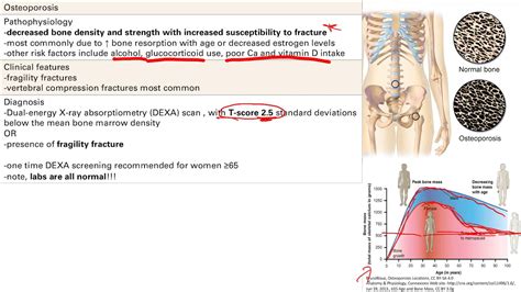 Bone Pathology Part Msk Step Simplified Youtube