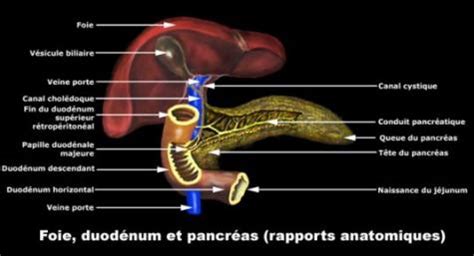 Pancreatite crônica causas sintomas tratamento Vulgaris medical