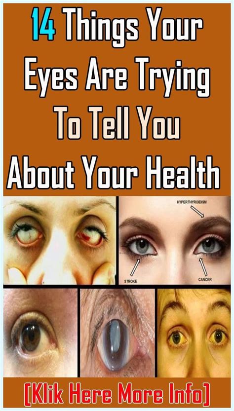 14 Things Your Eyes Say About Your Health Artofit