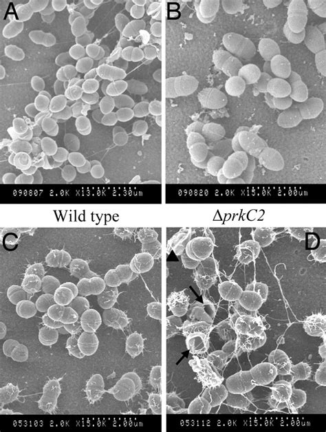 Enterococcus Faecalis Colony Morphology