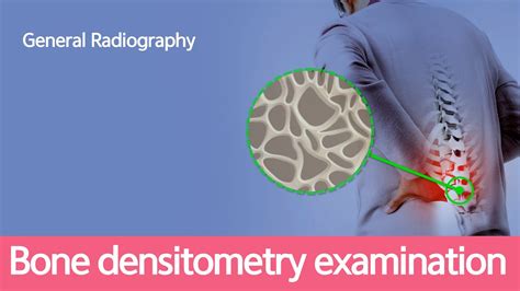 [general Radiography] Bone Densitometry Examination Youtube