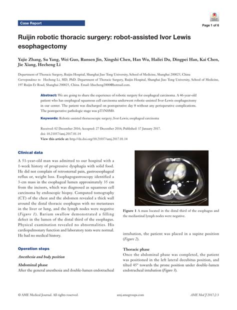 Pdf Ruijin Robotic Thoracic Surgery Robot Assisted Ivor Lewis