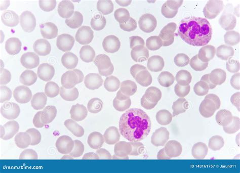 Neutrophil Cell In Blood Smear Stock Image Image Of Hemophilia Film