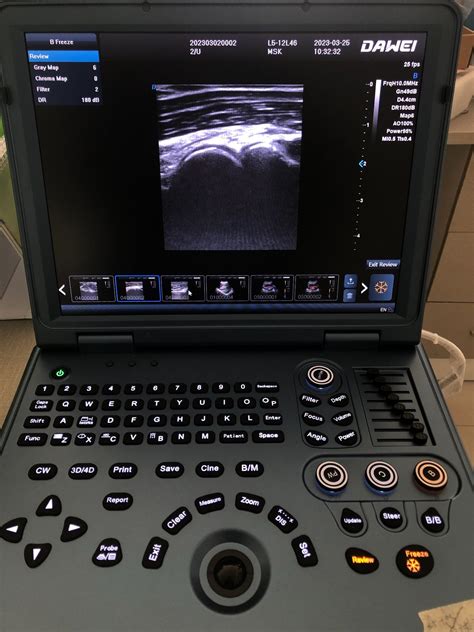 New Upgraded Laptop Color Doppler Ultrasound Dw L5 Easy For Carry