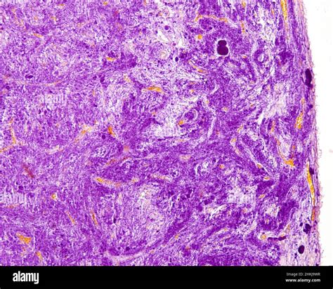 Posterior pituitary gland, light micrograph Stock Photo - Alamy