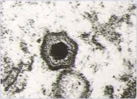 Electron micrograph of ASFV (source, INIA-CISA, Valdeolmos, Spain). By ...