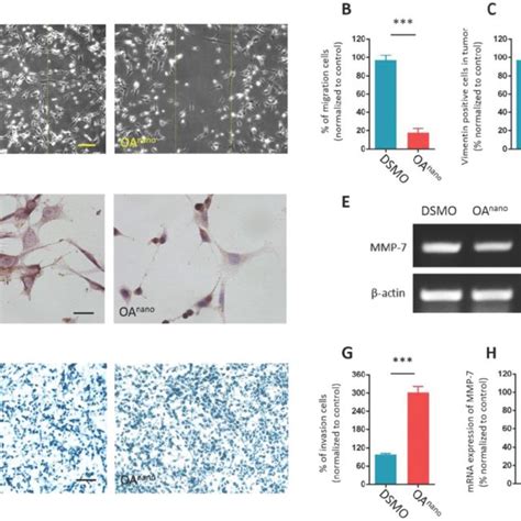 Oa Nano Suppresses Proliferation And Promotes Apoptosis Of U87 Glioma