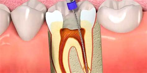 Especialidades Dentales Vittaoral Odontolog A