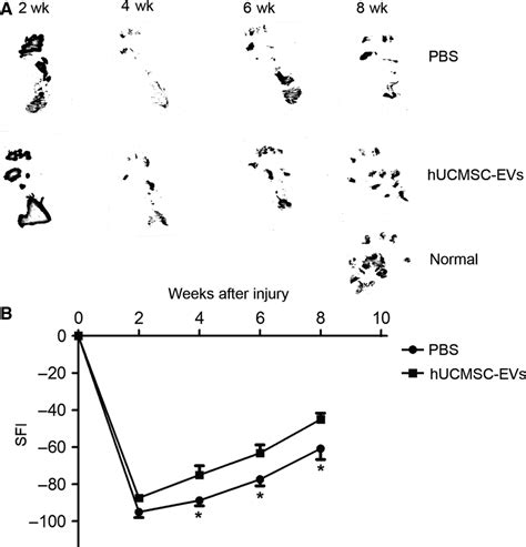 Human Umbilical Cord Msc‐derived Extracellular Vesicles Hucmsc‐evs