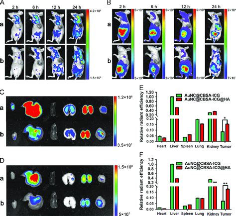 In Vivo Fluorescent Imaging Of Aunc Signal A And Icg Signal B The