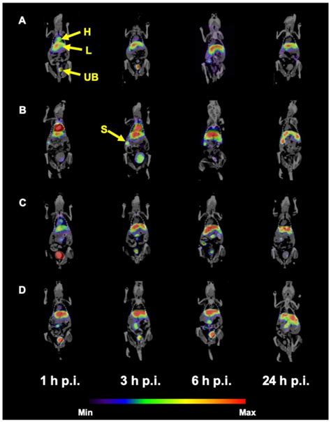 Coronal Slices Of SPECT CT Imaging Of 99mTc HEDP Labeled HAP NPs In