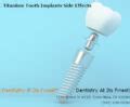 What Are The Side Effects Of Dental Implant With Titanium