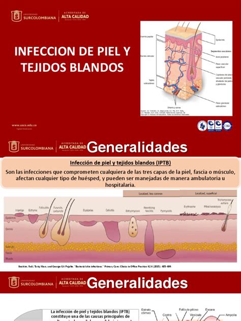Infección De Piel Y Tejidos Blandos Pdf Epidemiología Inmunología