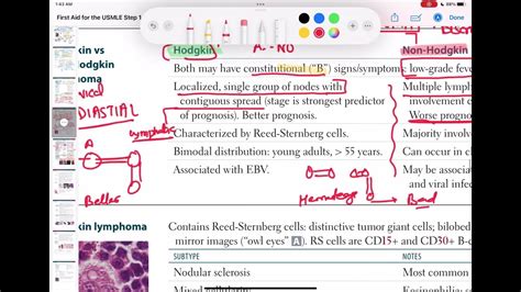 Hodgkin Vs Non Hodgkin Lymphoma Haematology 71 First Aid Usmle Step 1 In Urdu Hindi