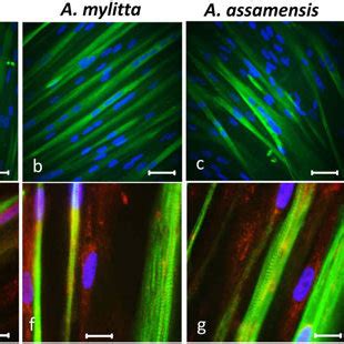 Human Skeletal Muscle Myoblasts HSMMs Differentiate To Form Myotubes