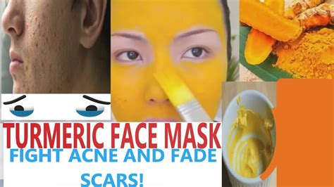 DIY TURMERIC FACE MASK Fight Acne And Fade Scars Remove