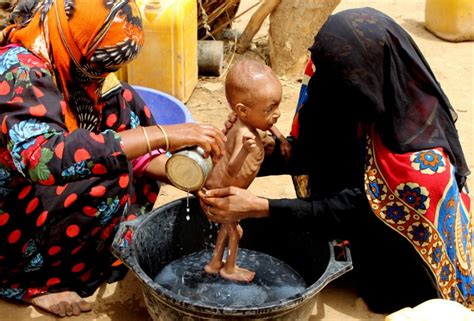 Yemenis Turn To Boiled Leaves As Famine Grips The Region