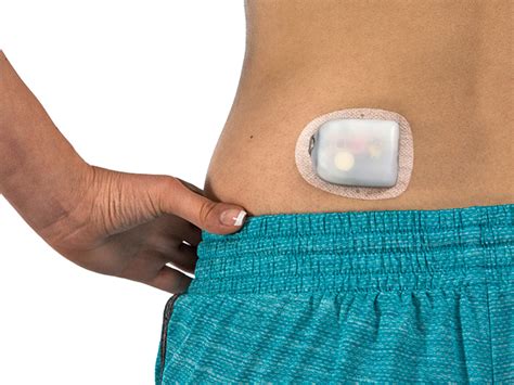 Handleiding Voor Pod Plaatsing Omnipod Nl