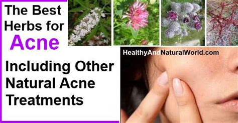 The Best Herbs For Acne Including Other Natural Acne Treatments