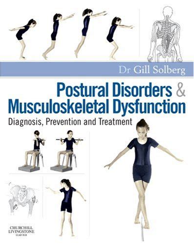 Postural Disorders And Musculoskeletal Dysfunction Diagnosis