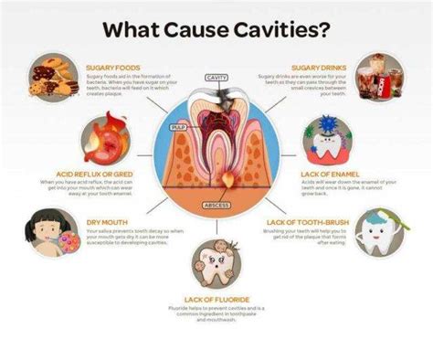 Dental Tooth Decay Treatment In India | Dental Cavity Treatment Near Me