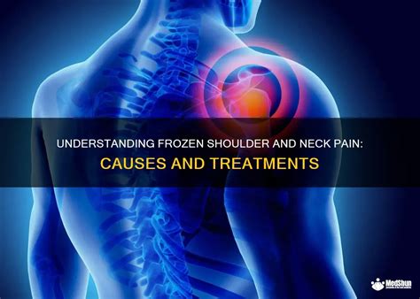 Understanding Frozen Shoulder And Neck Pain Causes And Treatments