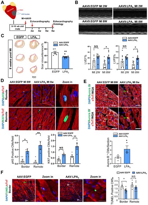 Cardiac Specific Overexpression Of Lpa Enhances Cardiac Function And