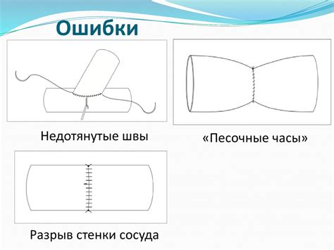 Сосудистый шов - online presentation