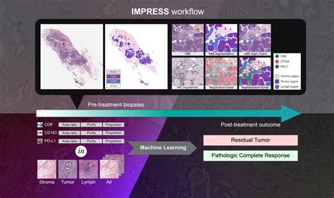 Artificial Intelligence Reveals Features Associated With Breast Cancer