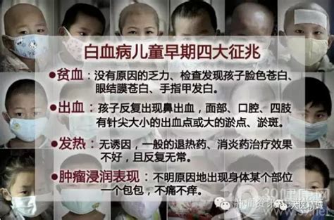 白血病患兒是被化療治死的嗎真相您絕對想不到 每日頭條