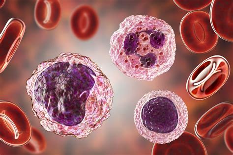 What Does High Neutrophils Low Lymphocytes Mean