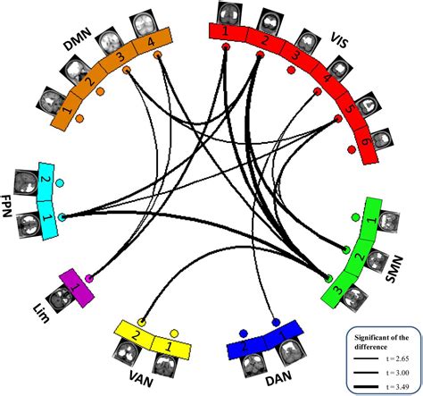 Frontiers Abnormal Static And Dynamic Functional Network Connectivity