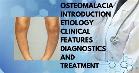 Osteomalacia Preeminent And Foremost Characteristics Introduction Etiology Clinical Features